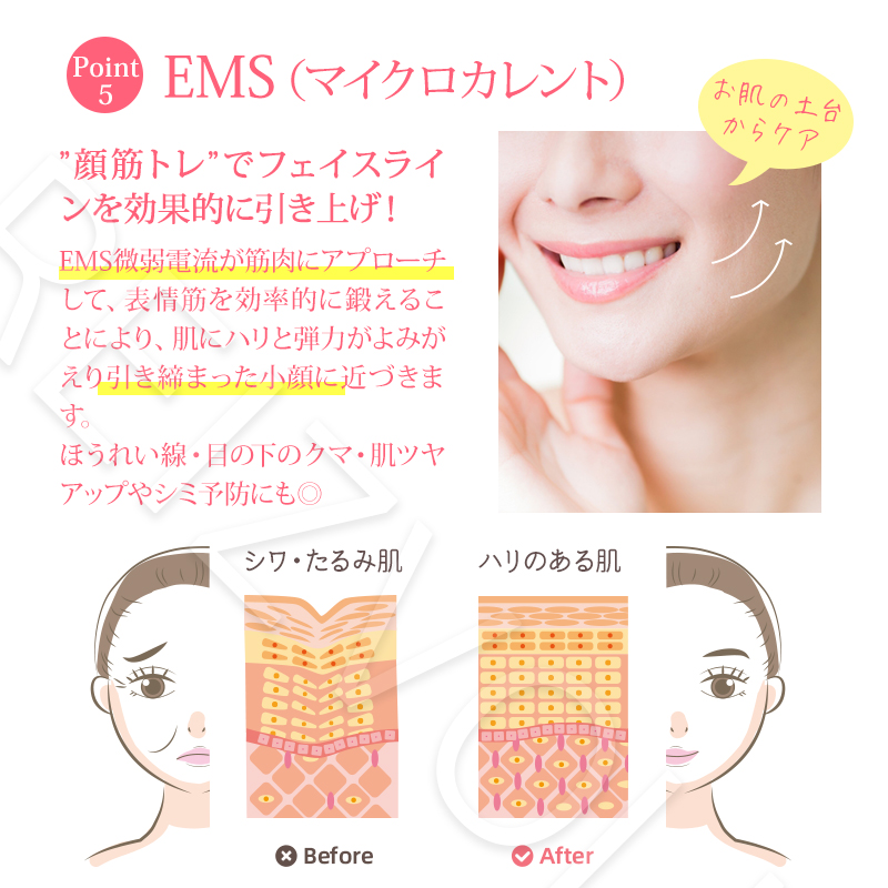 RF美顔器 Shine（シャイン）