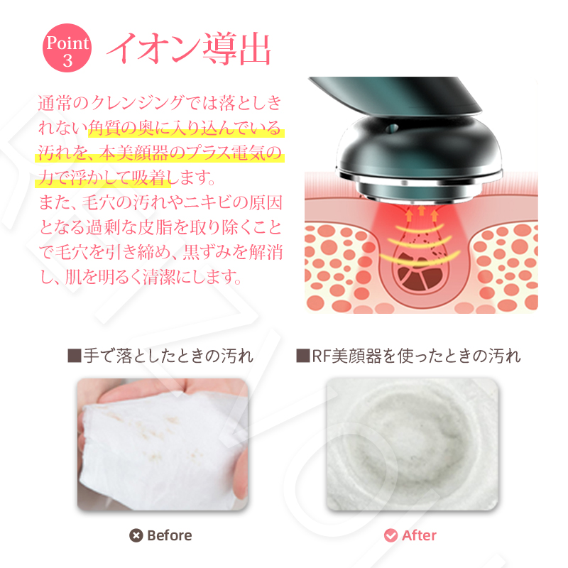 RF美顔器 Shine（シャイン）