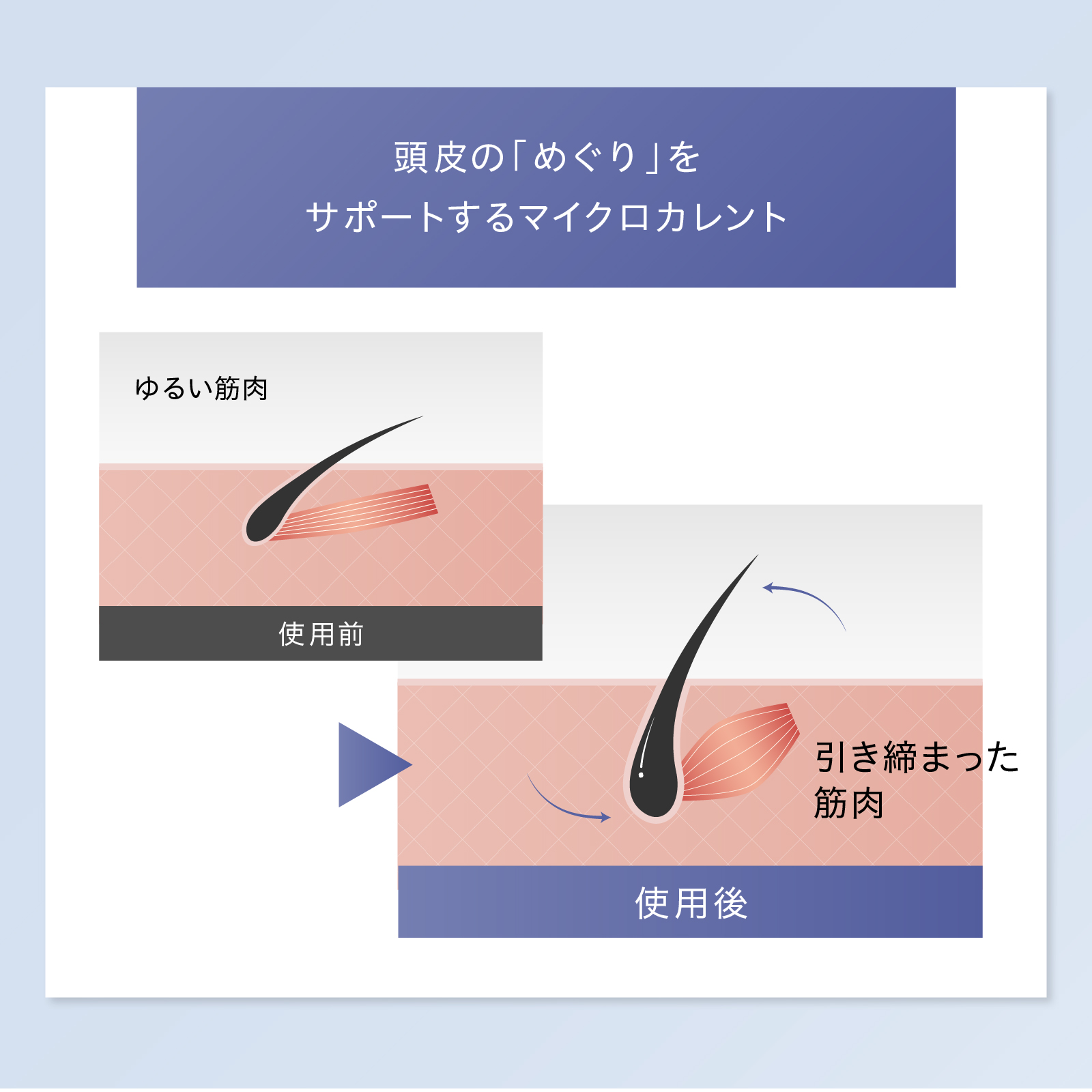 EMS Brush Air 【EMS×クッションブラシ】