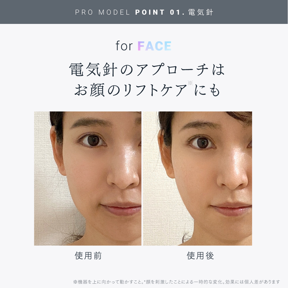 電気針ヘッドスパ EMS HEAD SPA PRO