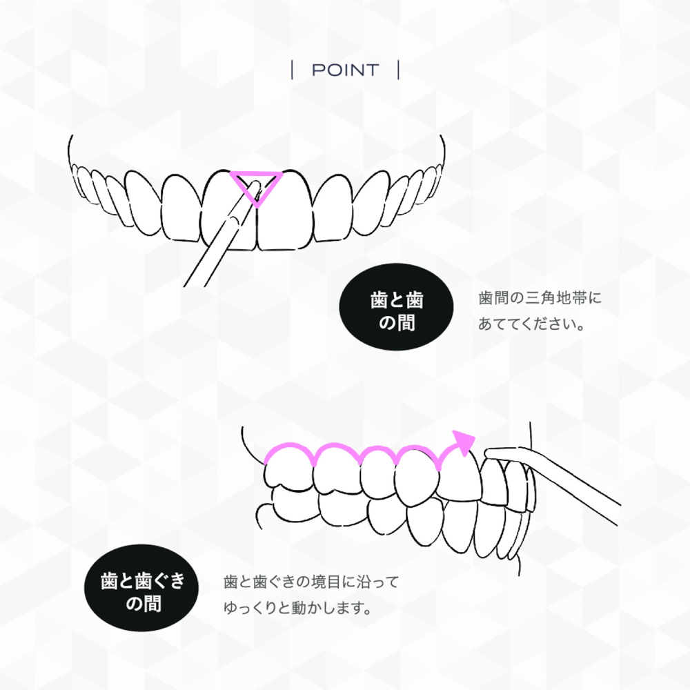 マウスウォッシャー/口腔洗浄器