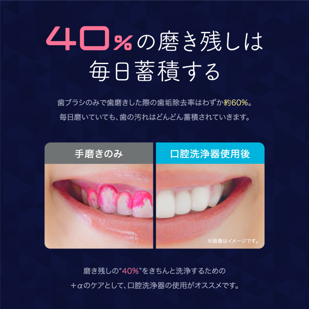 マウスウォッシャー/口腔洗浄器