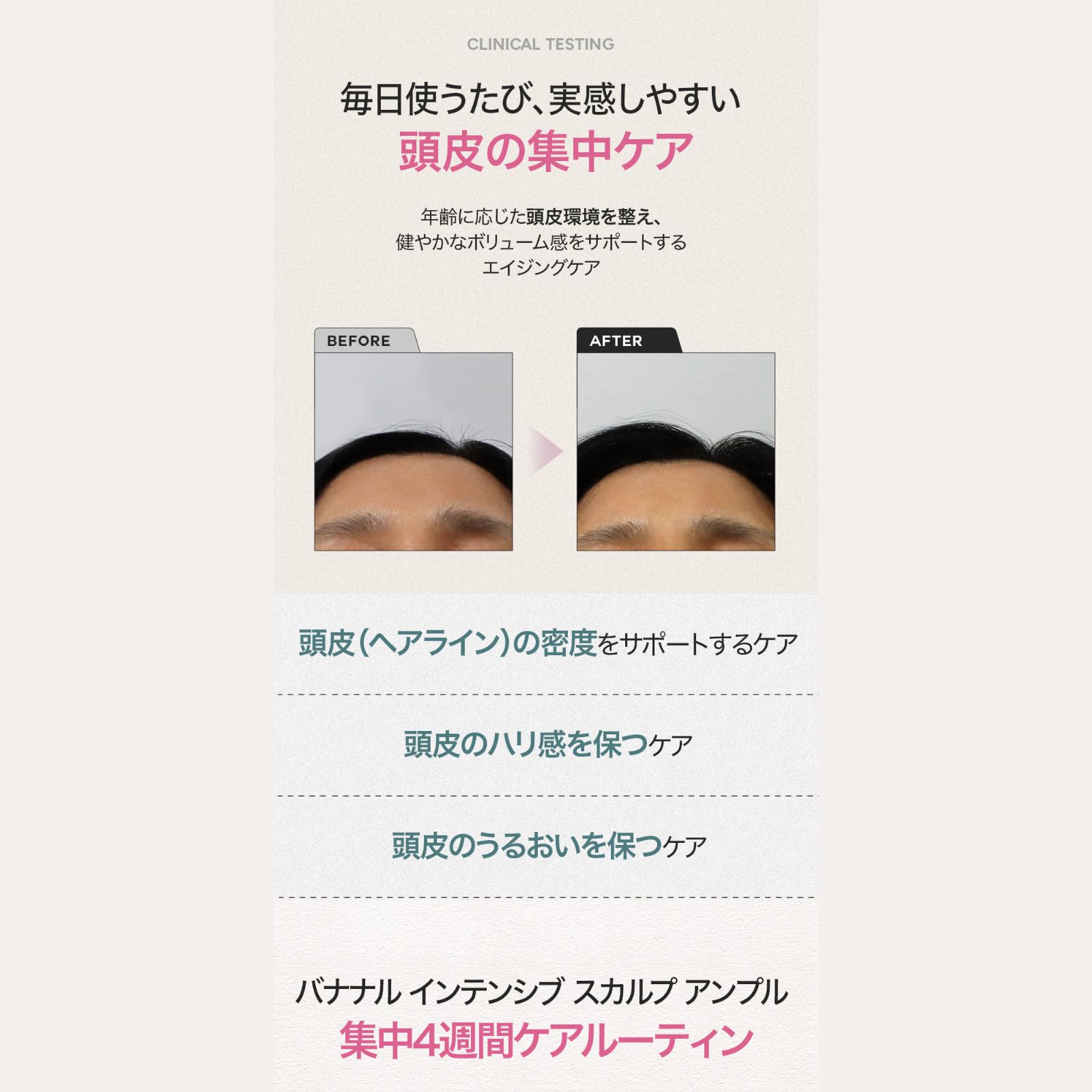 インテンシブスカルプアンプル 7000